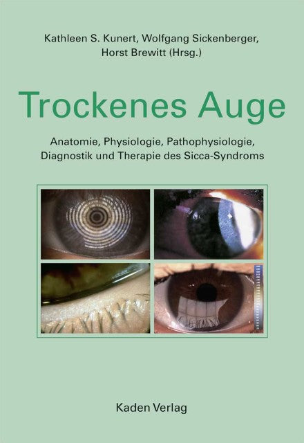 Buchcover: Trockenes Auge