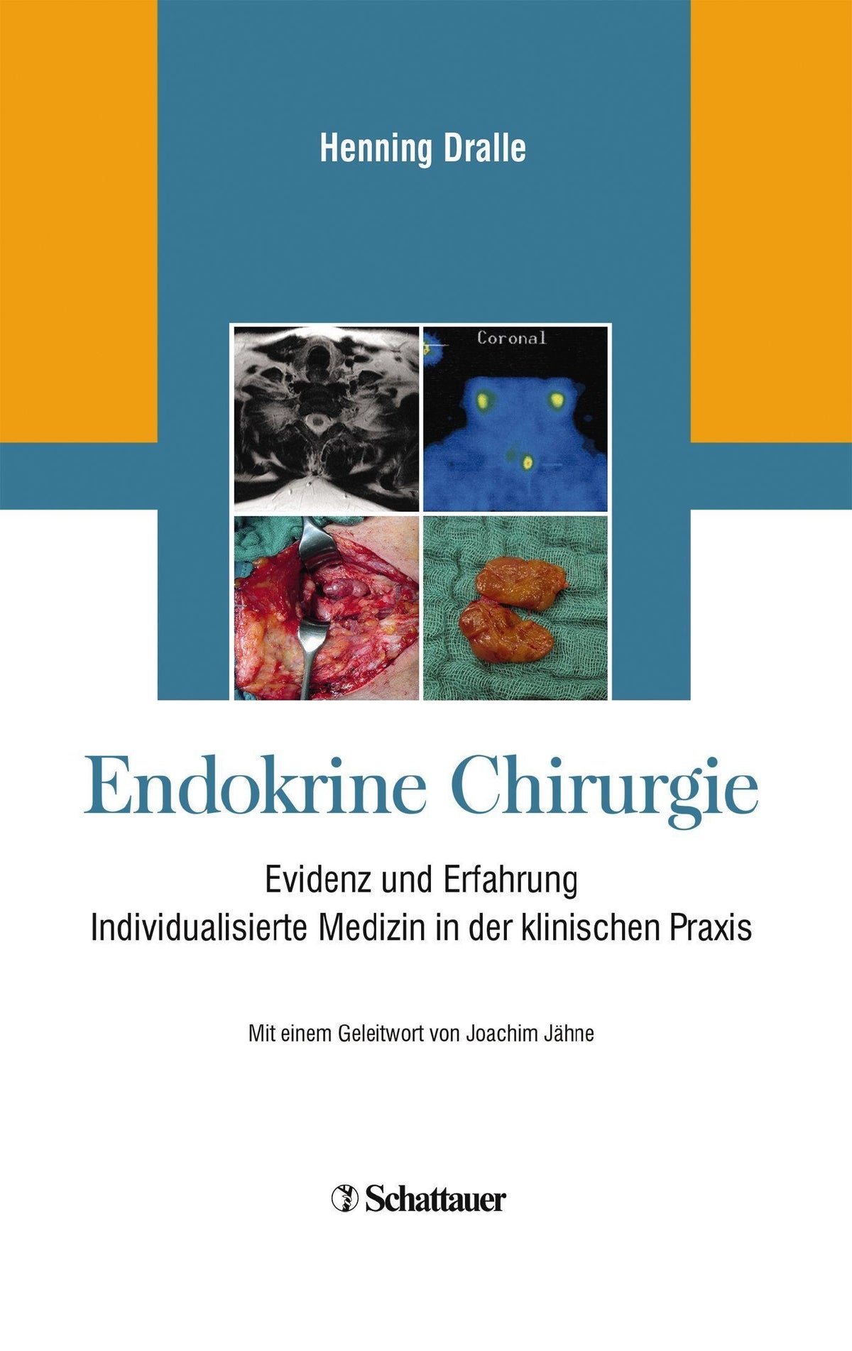 Buchcover: Endokrine Chirurgie