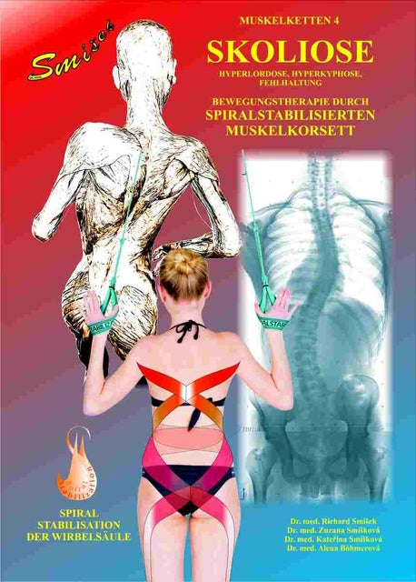 Buchcover: Skoliose