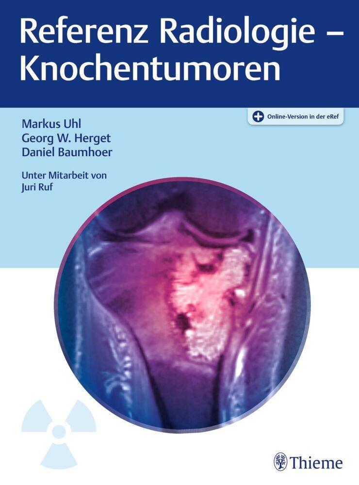Buchcover: Referenz Radiologie - Knochentumoren