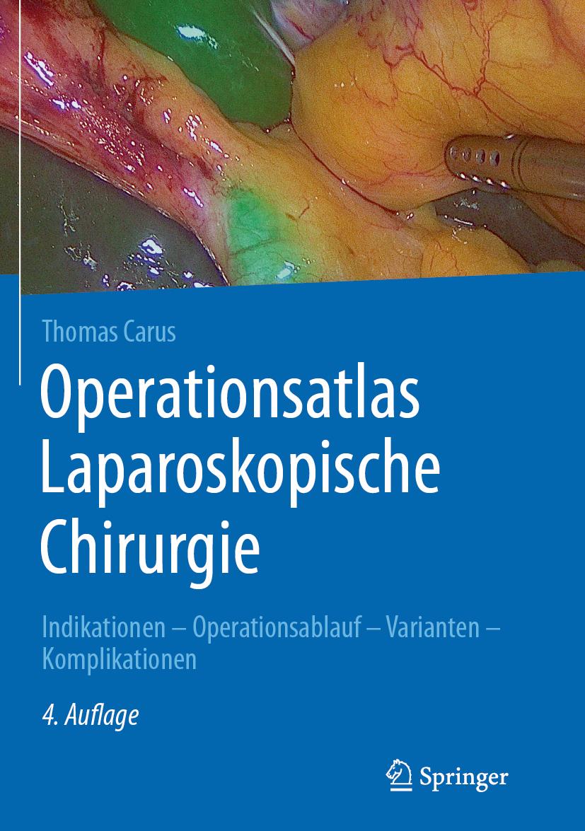 Buchcover: Operationsatlas Laparoskopische Chirurgie