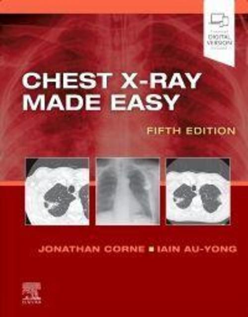 Buchcover: Chest X-Ray Made Easy